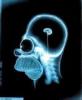 Homer Simpson's brain scan